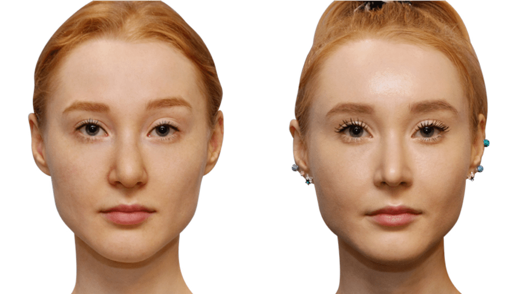 non invasive surgery korea